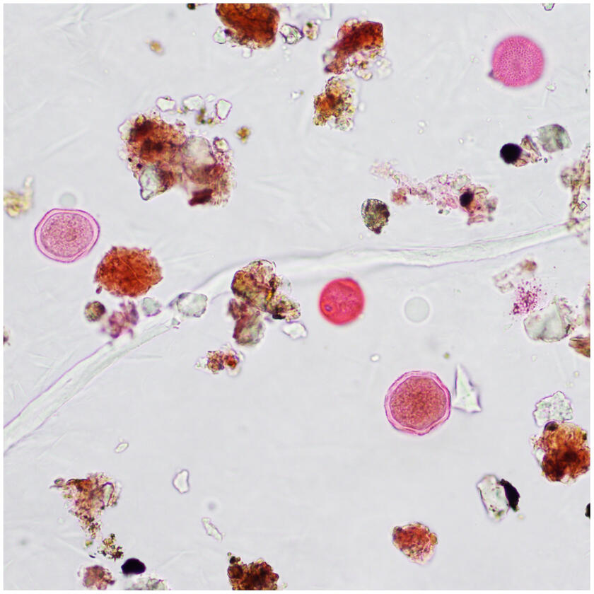 Pollen - photos taken by Dr. Letty Weger
